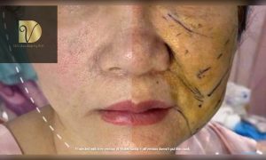 cang-chi-an-toan-da-nang