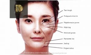 cang-chi-an-toan-da-nang