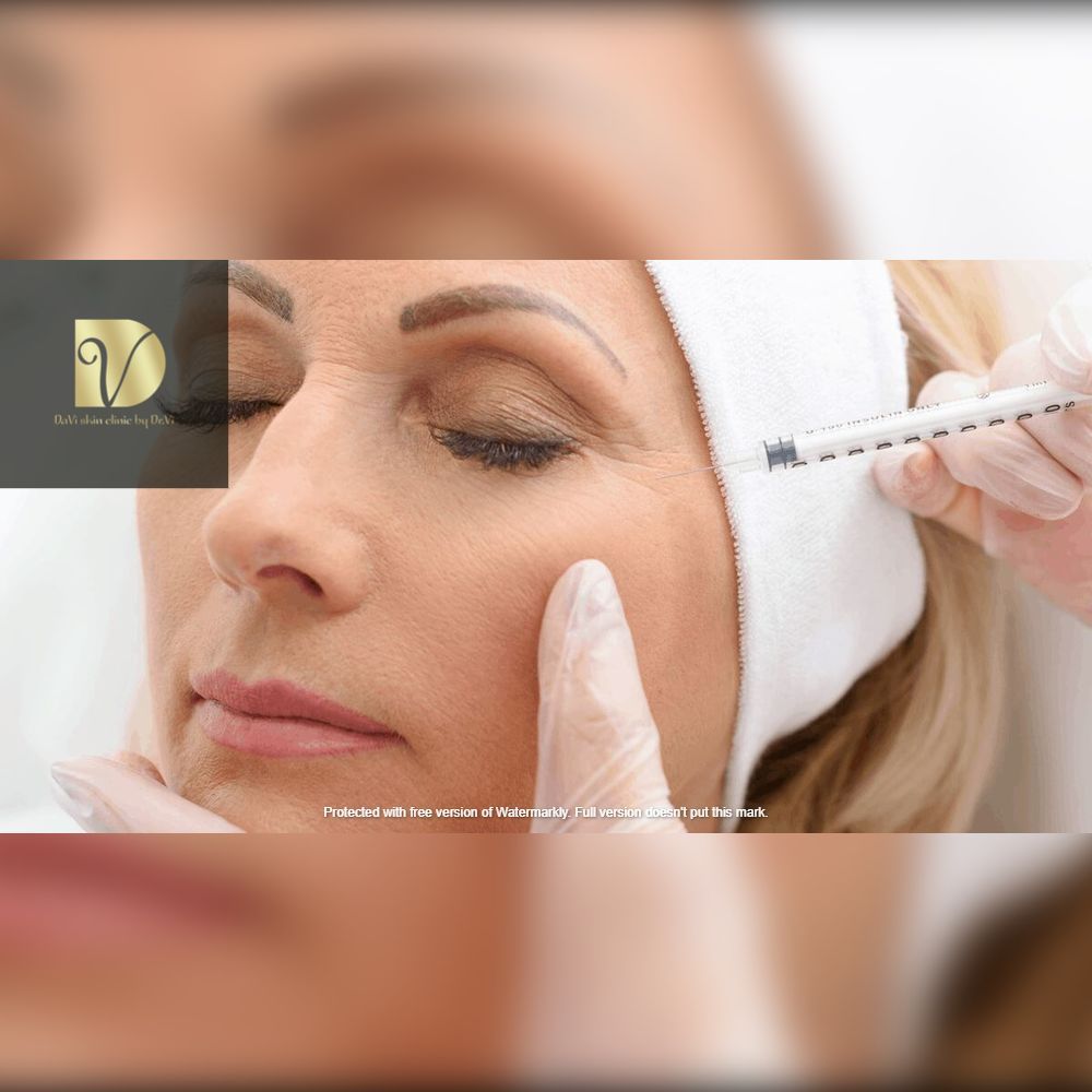 tiêm botox an toàn đà nẵng