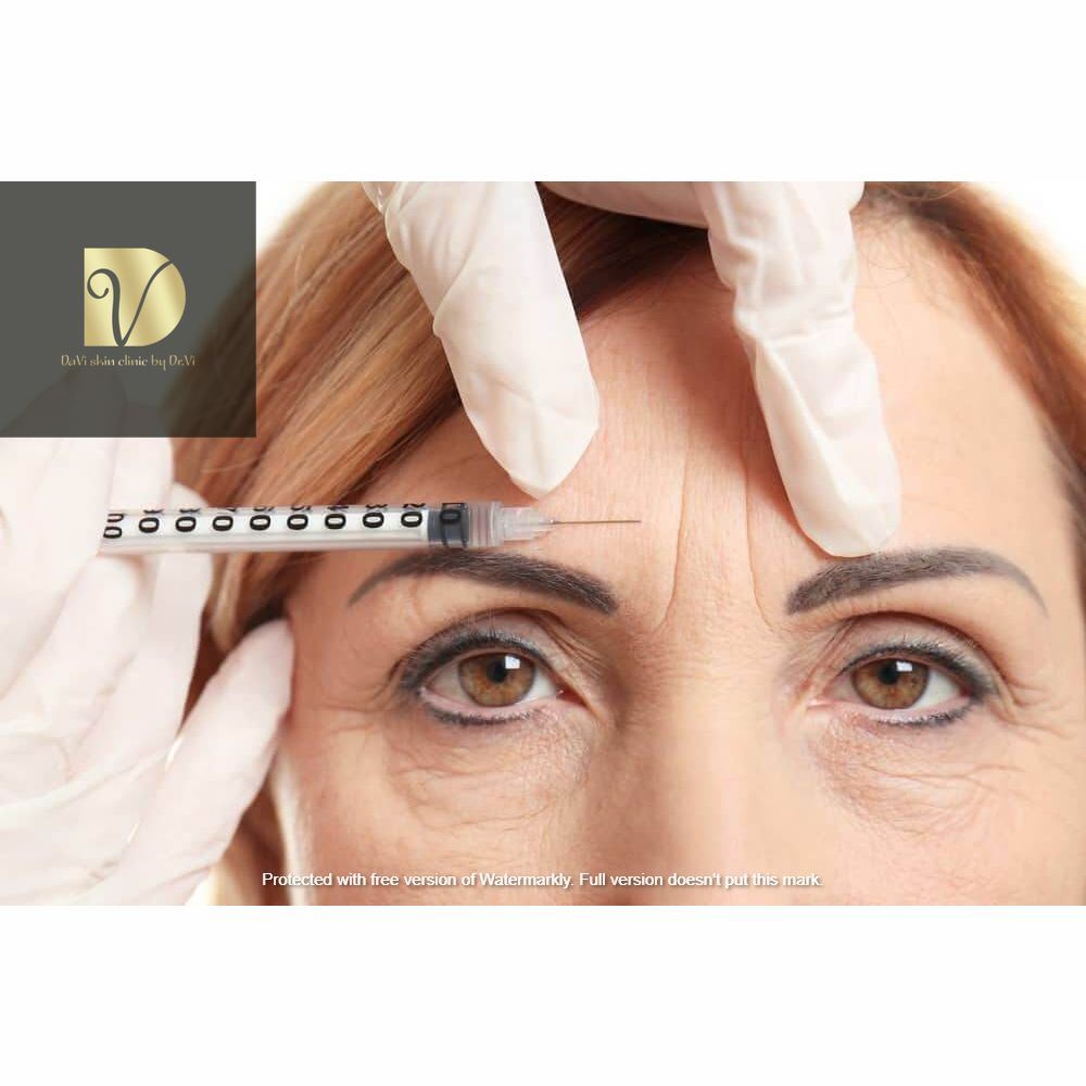 tiêm botox an toàn đà nẵng