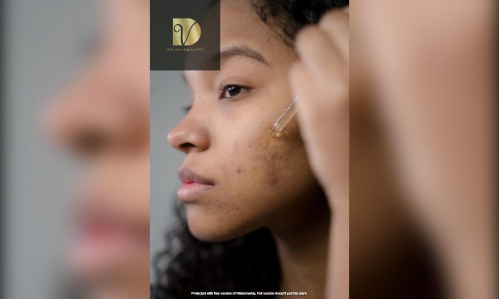 Tri tham mun Da Nang